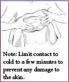 Note: Limit contact to cold to a few minutes to prevent any damage to the skin.