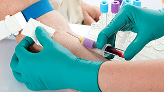 Photo of person having blood drawn